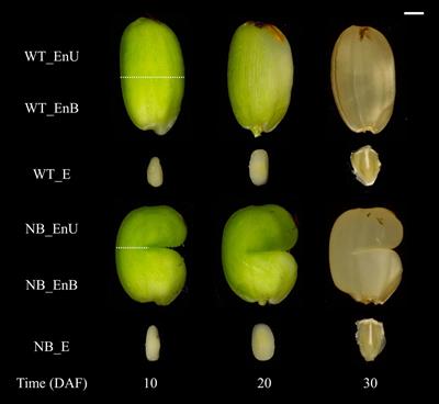 Metabolic Disturbance Induced by the Embryo Contributes to the Formation of Chalky Endosperm of a Notched-Belly Rice Mutant